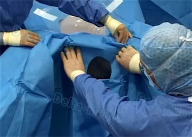 외과 복강경 검사는 ETO 파랑 색깔로, 메마른 처분할 수 있는 환자 주름잡아 드리웁니다 주름잡아 드리웁니다